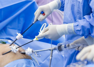 Laparoscopic Surgery